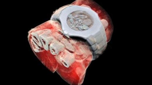   X-ray color and 3D scanning for the first time 