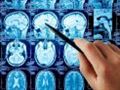   Computed tomography may increase the risk of brain cancer 