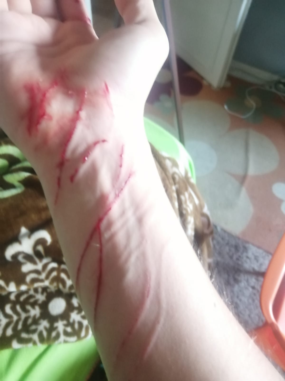 kedi elimi kolumu parçaladı parmağım kesilecek DonanımHaber Forum